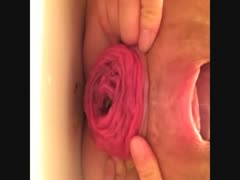 Big butthole releasing pinkish poop